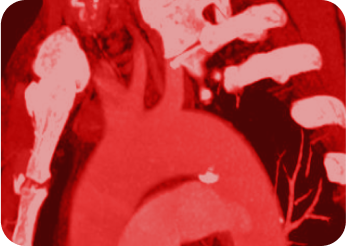 Frame 6